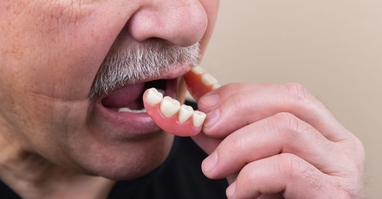 Jak pečovat o zubní protézu?